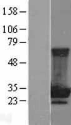 Western Blot: MOBKL2B Overexpression Lysate [NBL1-13172]