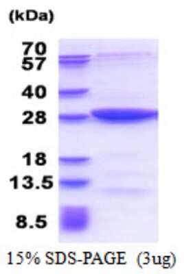 SDS-PAGE: Recombinant Human MOBKL2B His Protein [NBP2-51542]