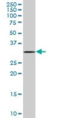 Western Blot: MOBKL2C Antibody [H00148932-B01P]