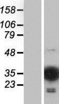 Western Blot: MOBKL2C Overexpression Lysate [NBP2-04610]