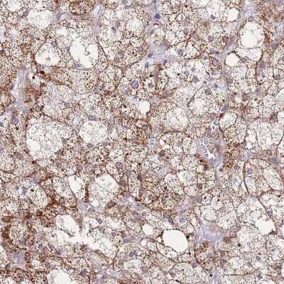 Immunohistochemistry-Paraffin: MOBKL3 Antibody [NBP2-14535]