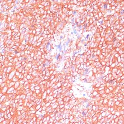 Immunohistochemistry-Paraffin: MOBKL3 Antibody - Azide and BSA Free [NBP3-03372]