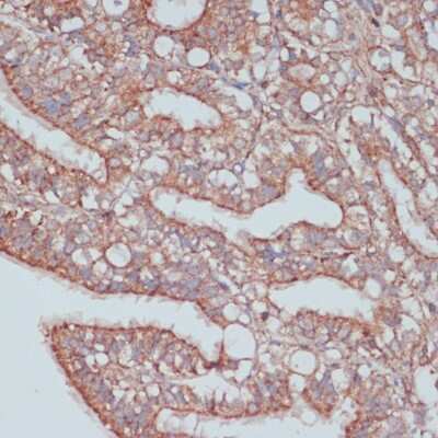 Immunohistochemistry-Paraffin: MOBKL3 Antibody - Azide and BSA Free [NBP3-03372]
