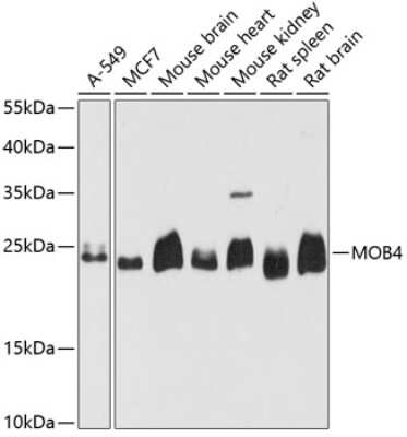 Western Blot: MOBKL3 AntibodyAzide and BSA Free [NBP3-03372]