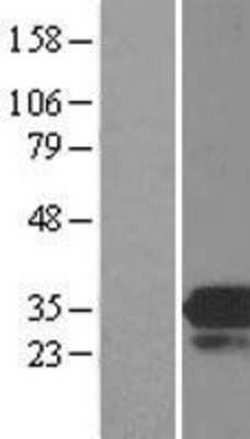 Western Blot: MOBKL3 Overexpression Lysate [NBL1-13173]