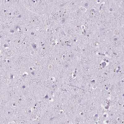 Immunohistochemistry-Paraffin: MOBP Antibody [NBP1-89430]