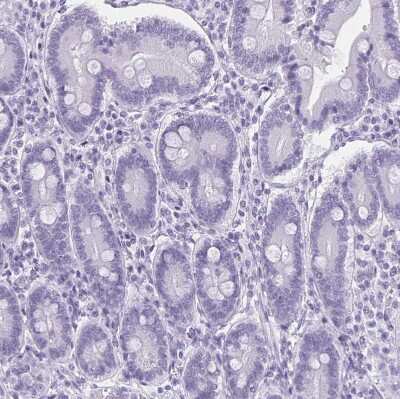 Immunohistochemistry-Paraffin: MOBP Antibody [NBP1-89430]