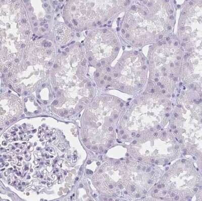 Immunohistochemistry-Paraffin: MOBP Antibody [NBP1-89430]