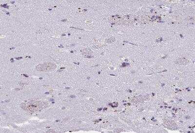 Immunohistochemistry-Paraffin: MOBP Antibody [NBP1-89430]