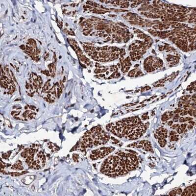 Immunohistochemistry-Paraffin: MOCOS Antibody [NBP2-14242]