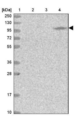 Western Blot: MOCOS Antibody [NBP2-14242]