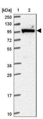 Western Blot: MOCOS Antibody [NBP2-14243]