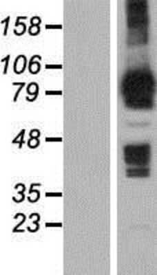 Western Blot: MOCOS Overexpression Lysate [NBP2-06896]