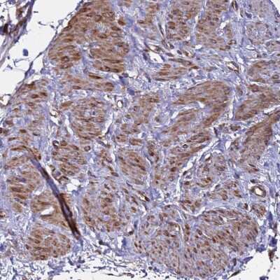 Immunohistochemistry-Paraffin: MOCS1 Antibody [NBP1-92130]