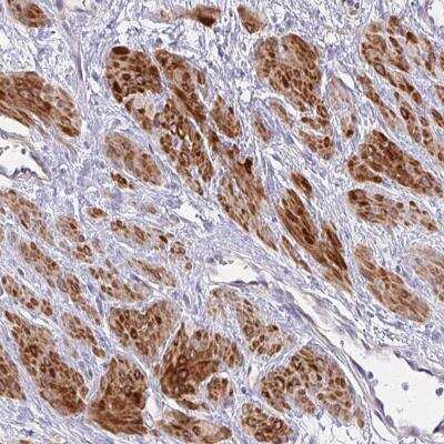 Immunohistochemistry-Paraffin: MOCS1 Antibody [NBP2-38844]