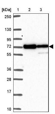 Western Blot: MOCS1 Antibody [NBP2-38844]