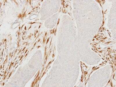 Immunohistochemistry-Paraffin: MOCS2 Antibody [NBP2-17319]
