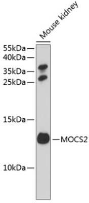 Western Blot: MOCS2 AntibodyBSA Free [NBP3-04485]