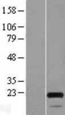 Western Blot: MOCS2 Overexpression Lysate [NBL1-13175]