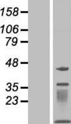 Western Blot: MOCS2 Overexpression Lysate [NBP2-05024]