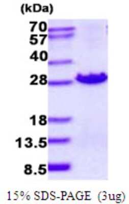 SDS-PAGE: Recombinant Human MOCS2 His Protein [NBP2-23250]