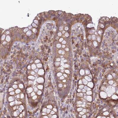 Immunohistochemistry-Paraffin: MOCS3 Antibody [NBP2-14244]