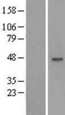 Western Blot: MOCS3 Overexpression Lysate [NBL1-13176]