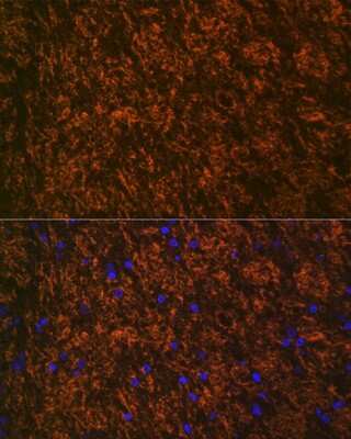 Immunohistochemistry: MOG Antibody (7G8C4) [NBP3-16310]