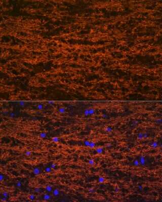 Immunohistochemistry: MOG Antibody (7G8C4) [NBP3-16310]
