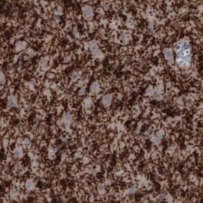 Immunohistochemistry-Paraffin: MOG Antibody (CL2858) [NBP2-46634]