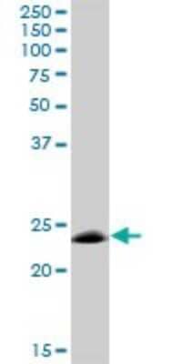 Western Blot: MOG Antibody [H00004340-B01P]