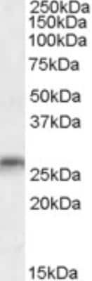 Western Blot: MOG Antibody [NB300-948]