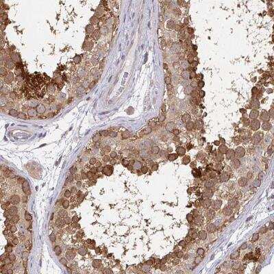 Immunohistochemistry-Paraffin: MOG1 Antibody [NBP2-31699]