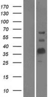 Western Blot: MOG Overexpression Lysate [NBP2-04536]