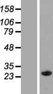 Western Blot: MOG1 Overexpression Lysate [NBP2-07025]