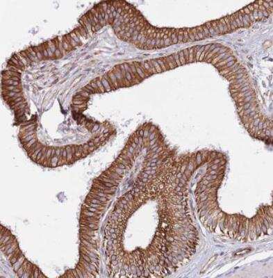 Immunohistochemistry-Paraffin: MOGAT1 Antibody [NBP2-14245]