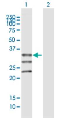 Western Blot: MOGAT1 Antibody [H00116255-B01P]