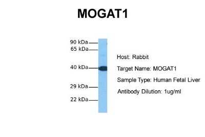 Western Blot: MOGAT1 Antibody [NBP1-59769]