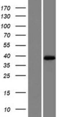 Western Blot: MOGAT1 Overexpression Lysate [NBP2-05739]