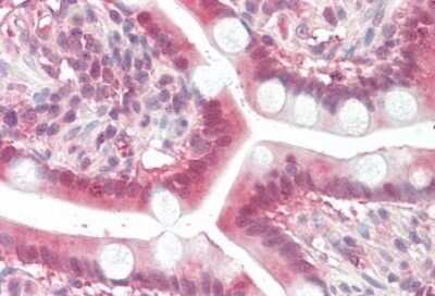 Immunohistochemistry-Paraffin: MOGAT2 Antibody [NBP1-52078]