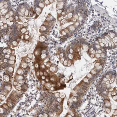 Immunohistochemistry-Paraffin: MOGAT2 Antibody [NBP1-85230]