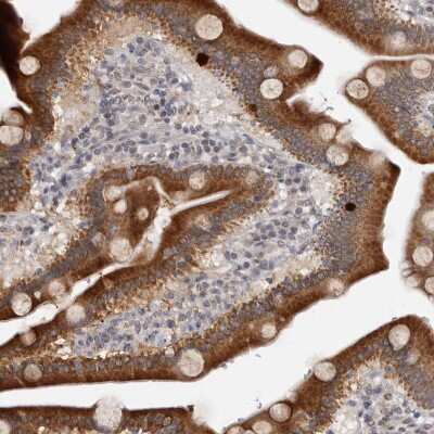 Immunohistochemistry-Paraffin: MOGAT2 Antibody [NBP1-85230]