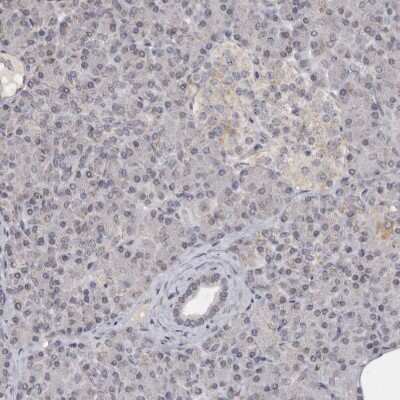 Immunohistochemistry-Paraffin: MOGAT2 Antibody [NBP1-85230]