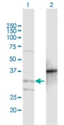 Western Blot: MOGAT2 Antibody [H00080168-B01P]