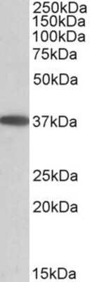 Western Blot: MOGAT2 Antibody [NBP1-52078]