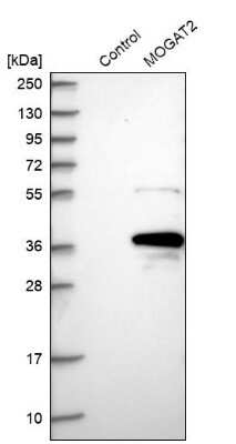 Western Blot: MOGAT2 Antibody [NBP1-85230]