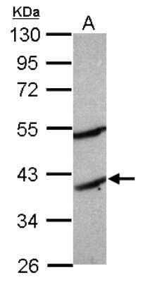 Western Blot: MOGAT2 Antibody [NBP2-19377]