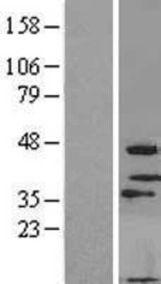 Western Blot: MOGAT3 Overexpression Lysate [NBL1-13178]