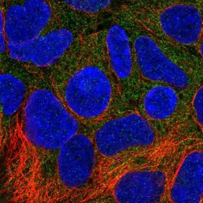 Immunocytochemistry/ Immunofluorescence: MON1A Antibody [NBP2-31702]