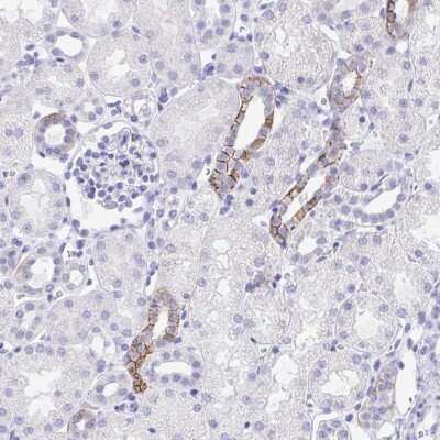 Immunohistochemistry: MON1A Antibody [NBP2-31565]